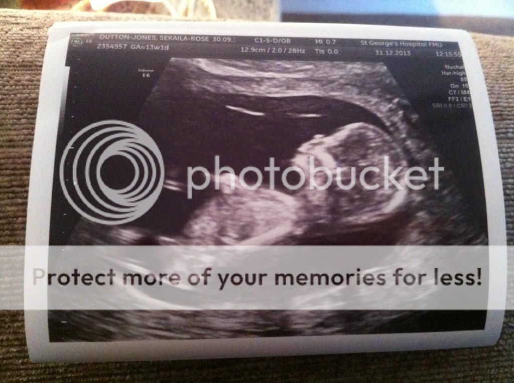 14 week scan picture boy or girl babycentre
